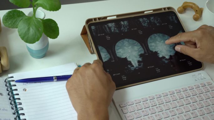 亚洲男性通过电子平板电脑看大脑核磁共振扫描来了解自己脑瘤的分期。