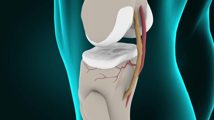 膝关节骨刺三维动画