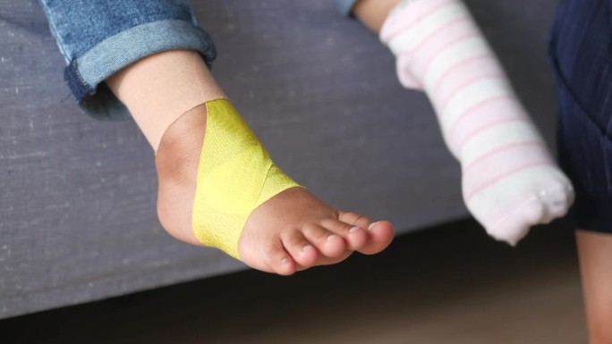 弹性治疗蓝带应用于儿童腿部。肌内效贴敷治疗损伤