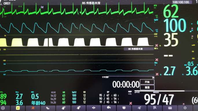 医疗监控屏幕：心电图与生命体征数据展示