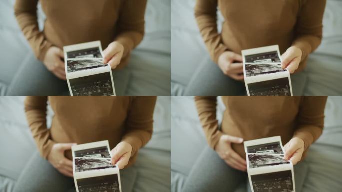 近距离孕妇看3D超声扫描照片