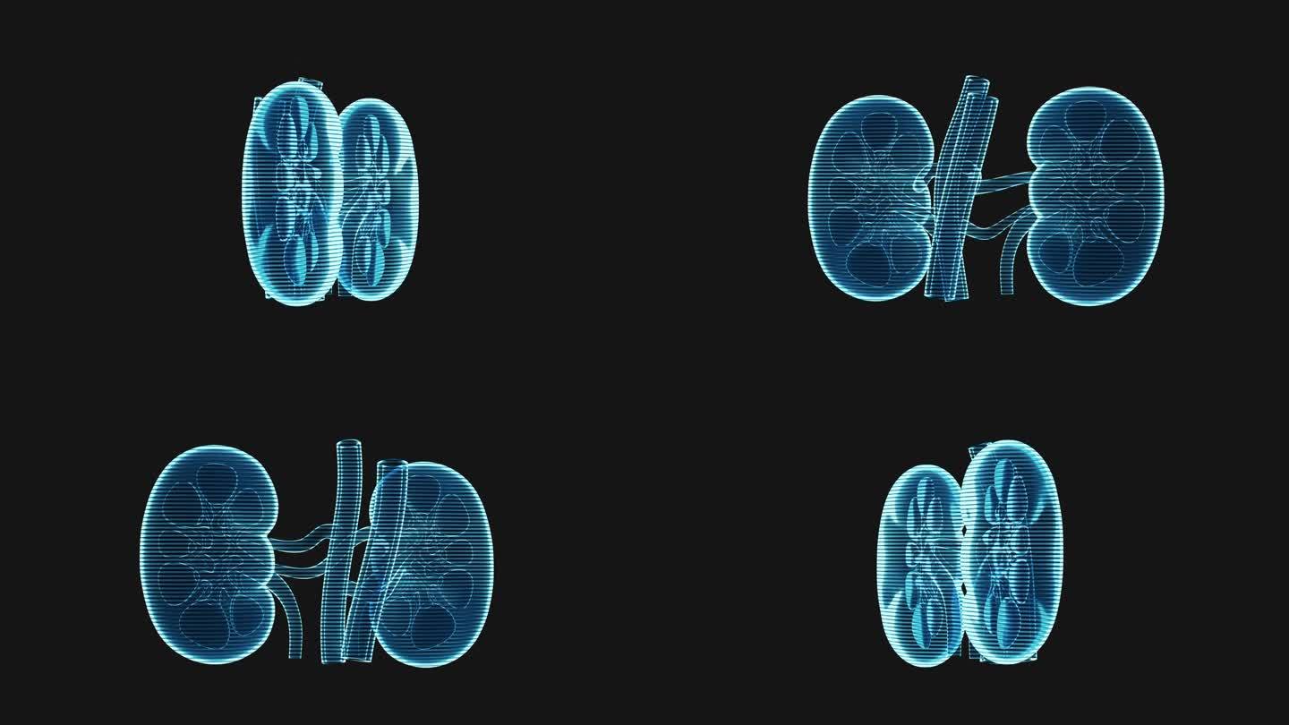 肾脏全息影像效果图3D渲染