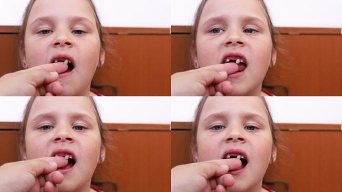 小女孩看着镜头的脸带着婴儿牙龈牙齿的问题。剪短的手抖乳牙。牙医