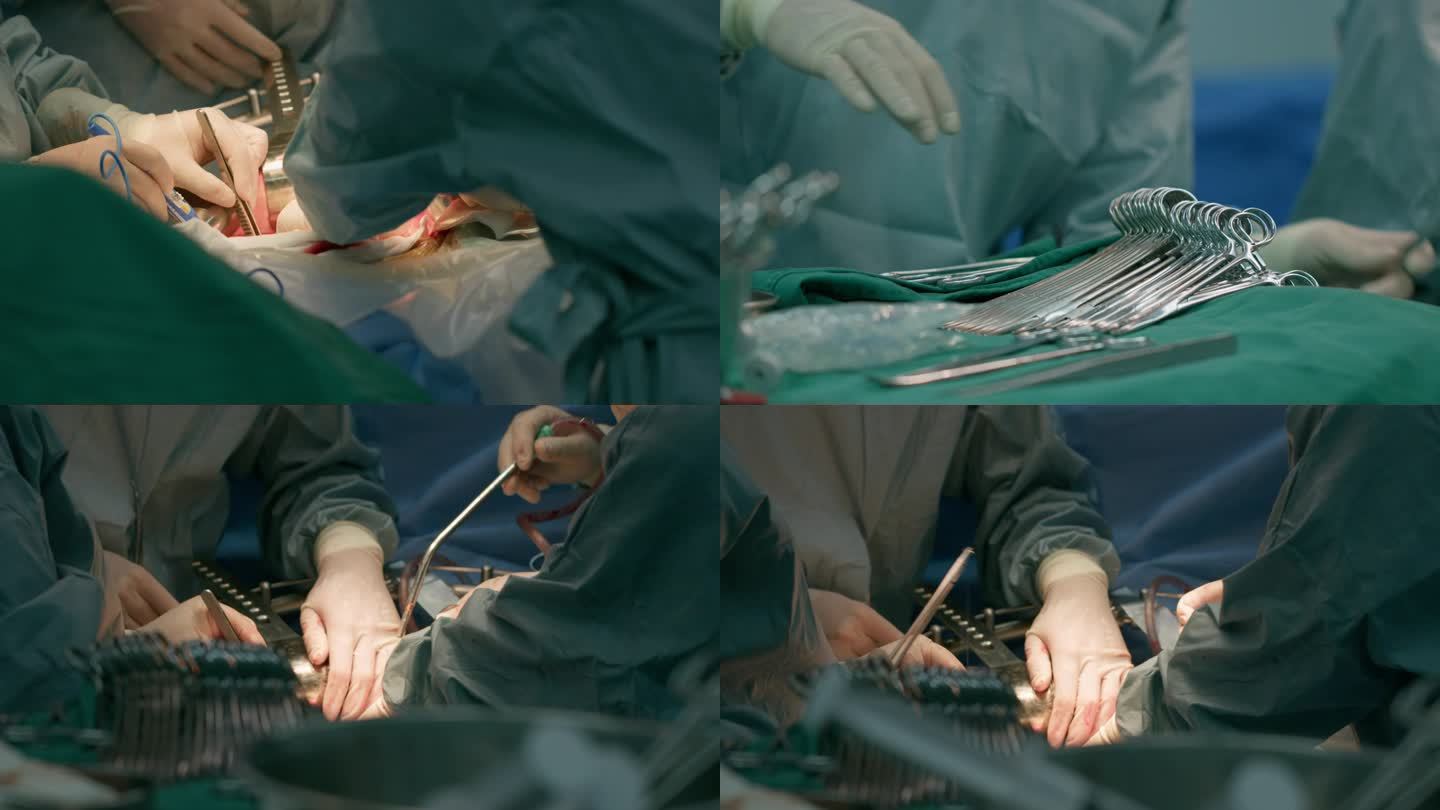 4K 外科开胸手术特写 无影灯下手术器械