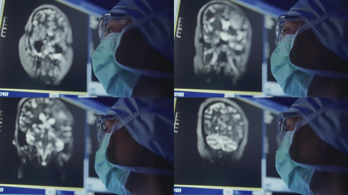 外科医生在MRI扫描上的观察和分析