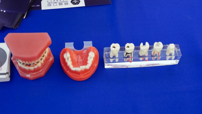 牙齿牙模具展示牙齿疾病