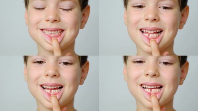 儿童乳牙脱落。六岁的孩子露出第一颗脱落的乳牙