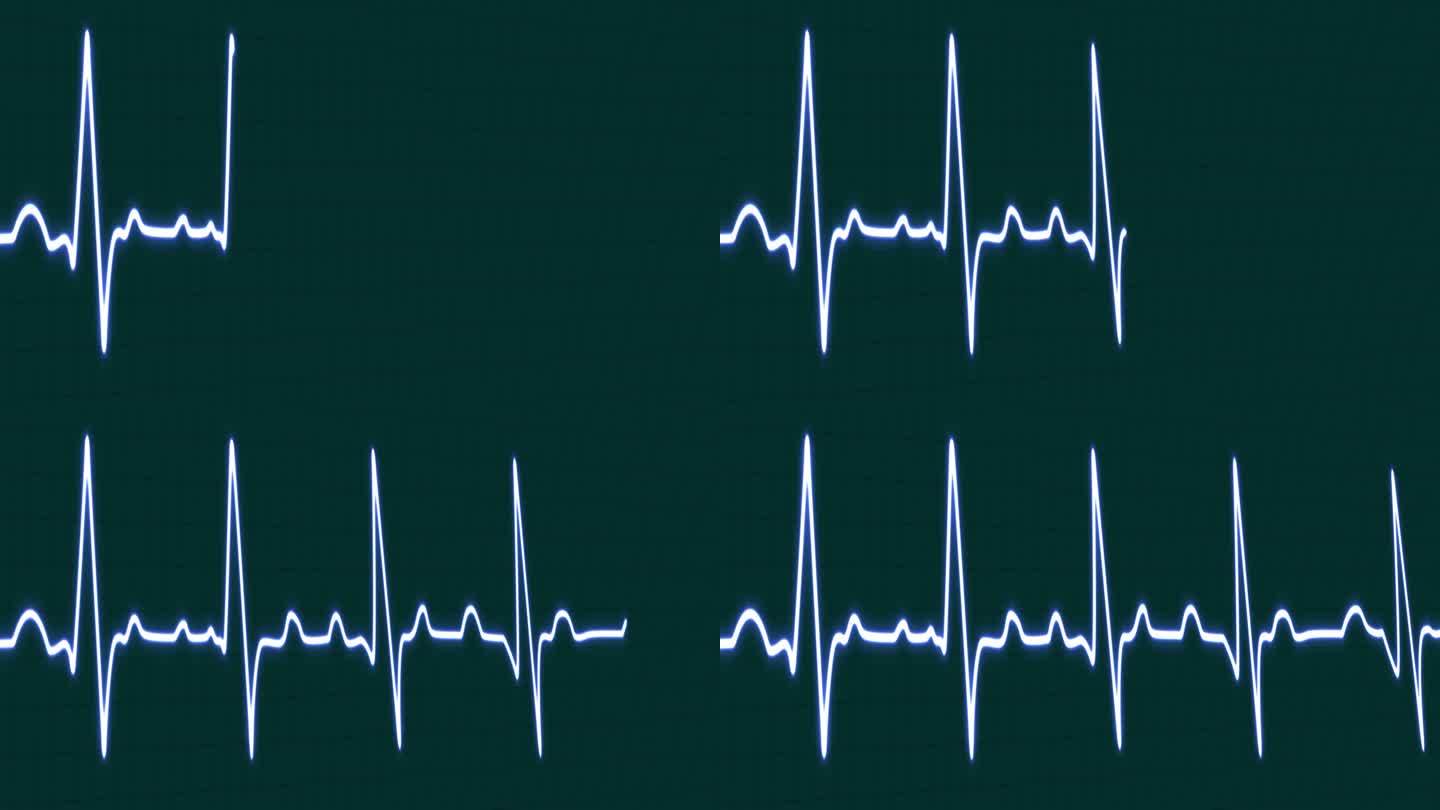心跳仪心跳脉搏率线发光蓝色霓虹灯环动画蓝色网格背景。蓝色带网格。心率监测器。医疗保健理念。4k镜头和