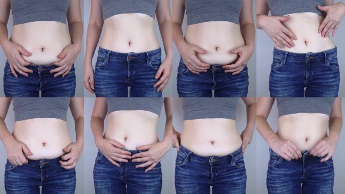 肥胖脂肪团。女性腰部多余脂肪的褶皱。前后对比。减肥的概念，运动，检查结果从饮食和高强度训练。减肥的结