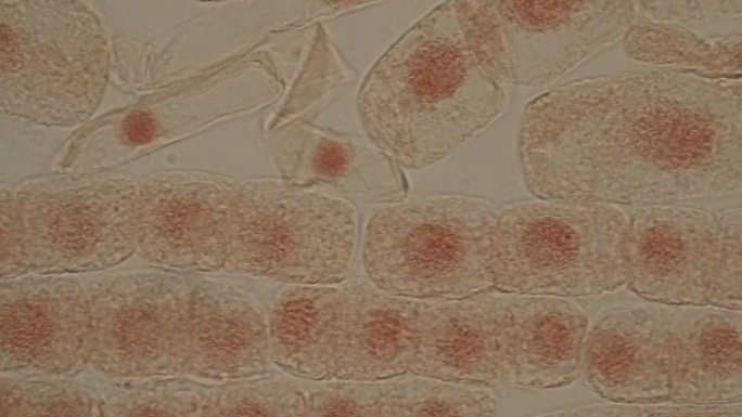 显微镜下洋葱根尖的有丝分裂细胞。