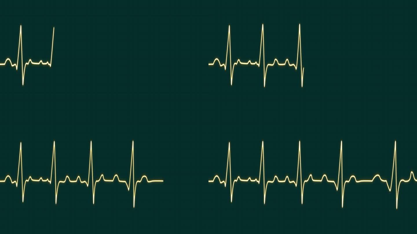 心跳仪心跳脉搏率线发光黄色霓虹灯环动画蓝色网格背景。蓝色带网格。心率监测器。医疗保健理念。4k镜头和