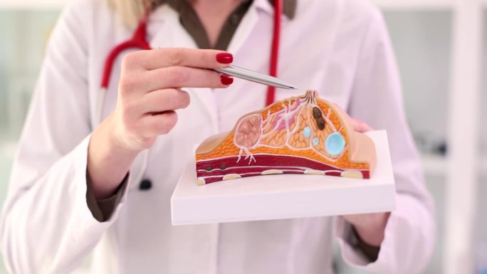 女医生用乳房解剖模型讲解疾病