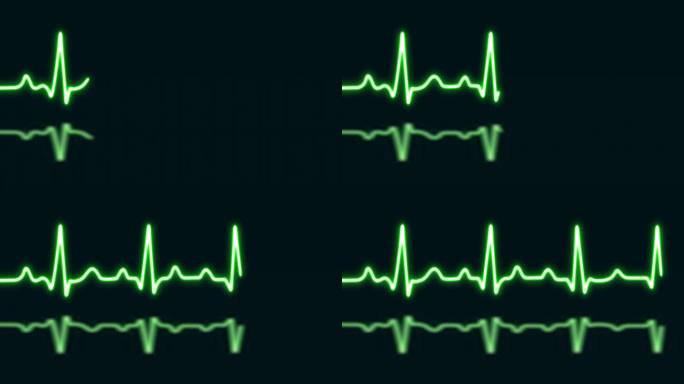 绿色霓虹心跳与爱的形状孤立在蓝色网格背景。医学概念和心电脉搏曲线图