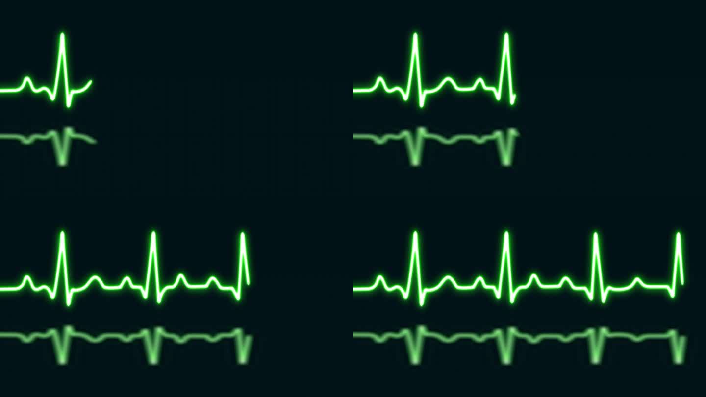 绿色霓虹心跳与爱的形状孤立在蓝色网格背景。医学概念和心电脉搏曲线图