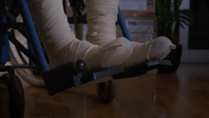 在石膏上包扎的腿断了，事故，病人在轮椅上滚动