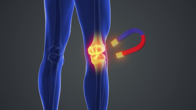 磁铁治疗膝关节疼痛