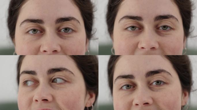 激光视力矫正。特写的绿色眼睛微笑的女人。眼科和眼病的概念