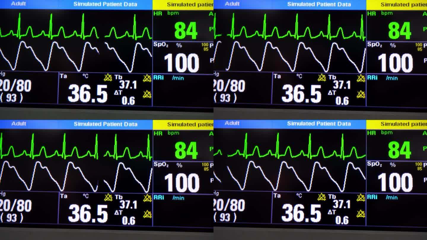 生命体征监测仪心脏监测监护医疗设备