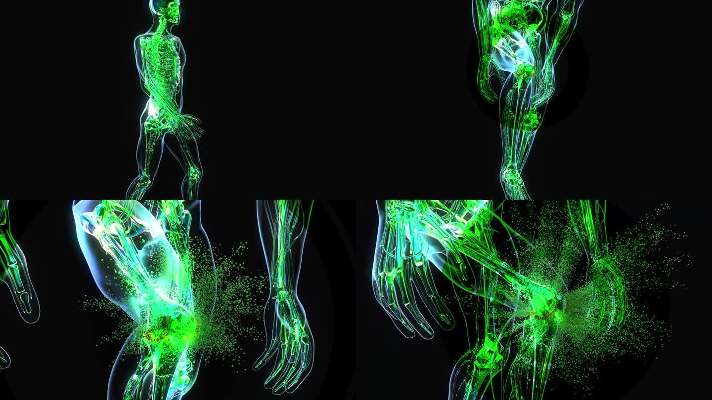 4K动画对骨关节炎和膝关节病理的影响