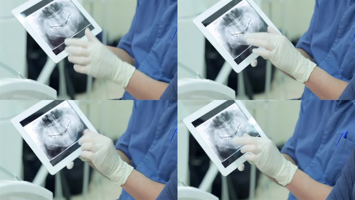 平板电脑上牙齿的x光照片特写