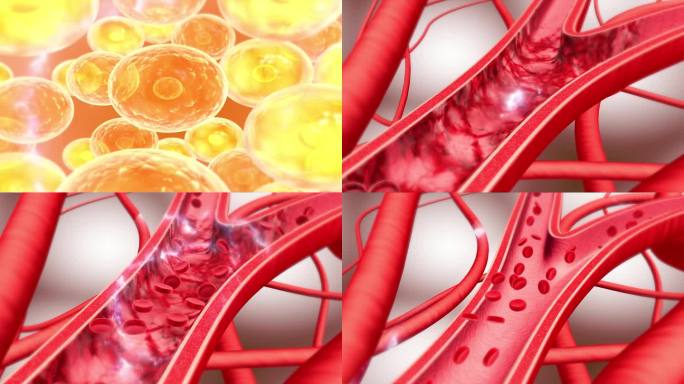 AE细胞 修复细胞 细胞恢复 活性血管