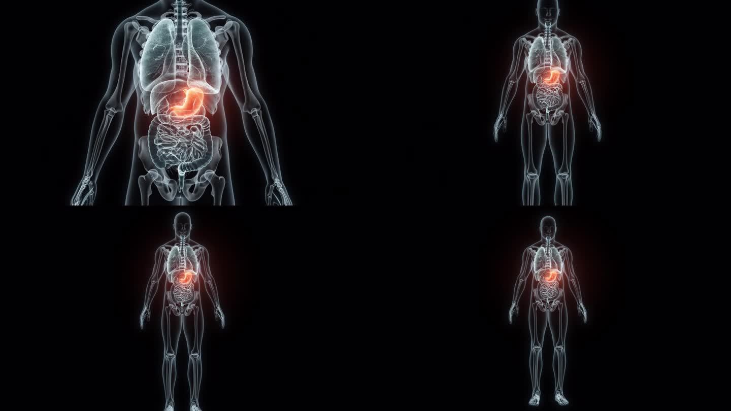 人体胃的3D渲染医学动画。胃x光片