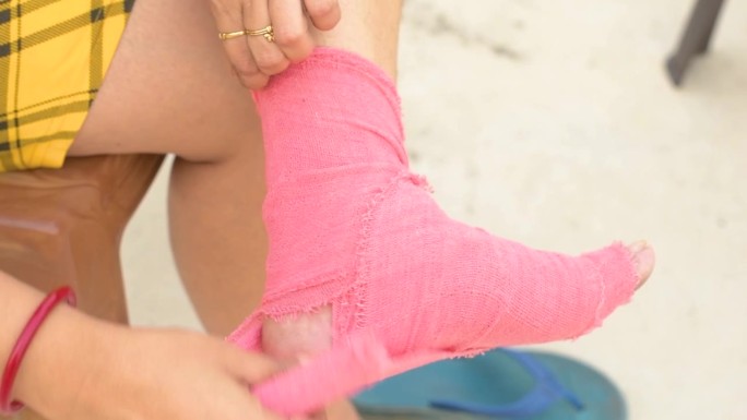 一名女子正在包扎扭伤的脚踝，锻炼受伤，腿部特写