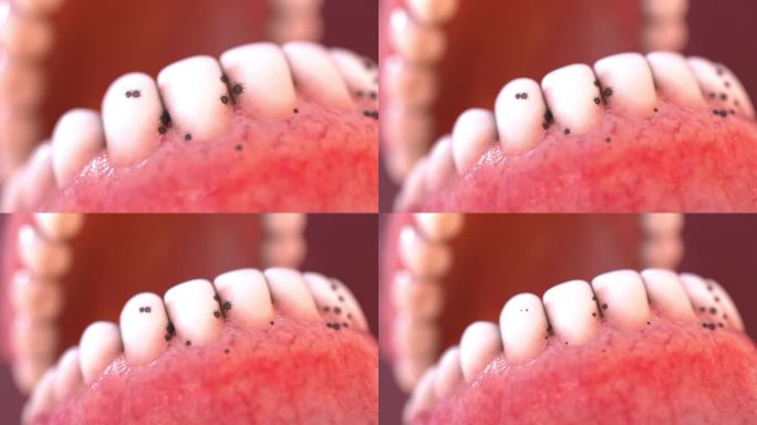 写实牙齿杀菌口腔清洁消毒刷牙去除牙垢牙医