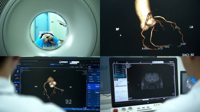 医院ct检查 核磁共振 体检