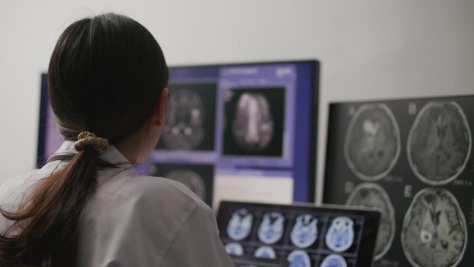 女放射科医生分析头部扫描的跟踪镜头