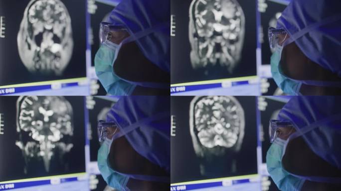 女医生在电脑显示器上看核磁共振扫描检查