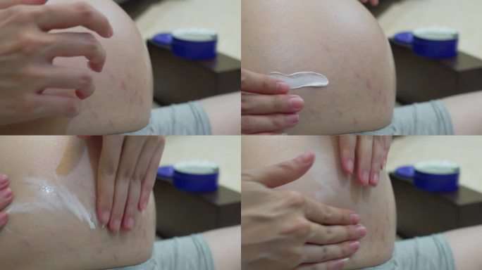 孕妇在大肚子上涂抹保湿霜。
