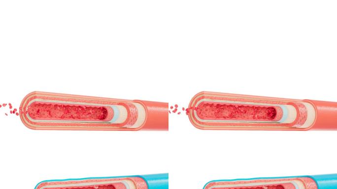 动静脉解剖竖屏试剂红细胞