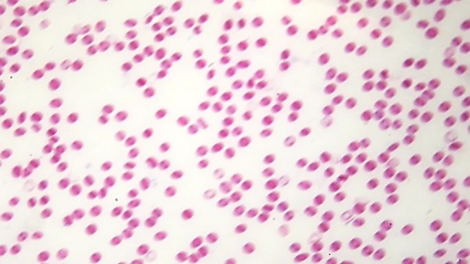显微镜下的红细胞和白细胞。科学课。在固定和染色的样品上观察人体血液成分。生化实验室。放大400倍。对