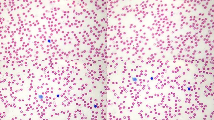 显微镜下的红细胞和白细胞。科学课。在固定和染色的样品上观察人体血液成分。生化实验室。放大400倍。对