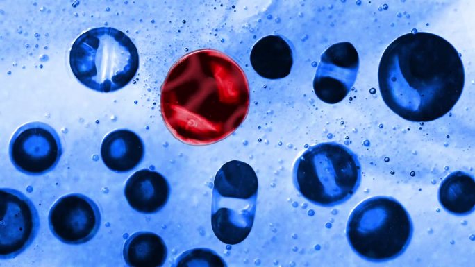 球体气泡就像变异的细胞。在显微镜下形成一个受损的细胞