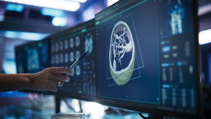 现代癌症研究医学中心:匿名医生指着桌面电脑显示器，用3D软件显示基于CT扫描的人脑。神经科医生在病人