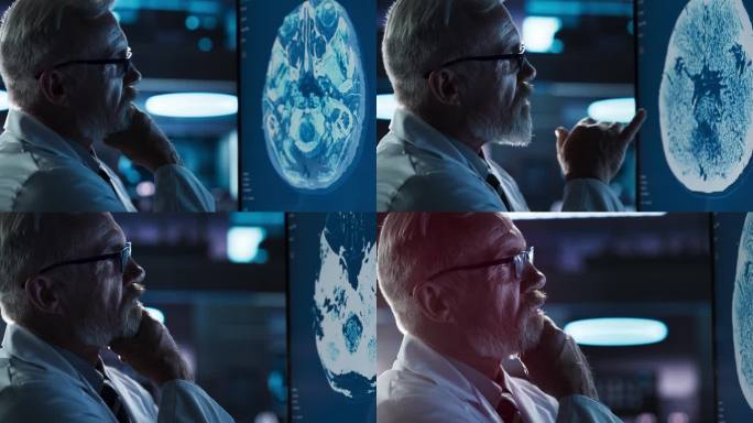 医学医院研究中心:白人男性神经学家，神经科学家，神经外科医生，看着电视屏幕与脑PET扫描图像的特写肖