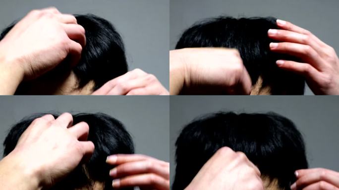 日本男性正遭受头发稀疏的困扰