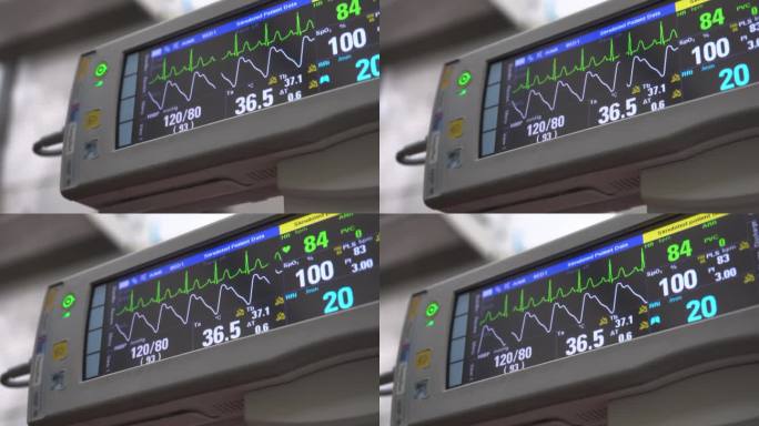 生命体征监测仪生命体征医疗设备脉搏监测