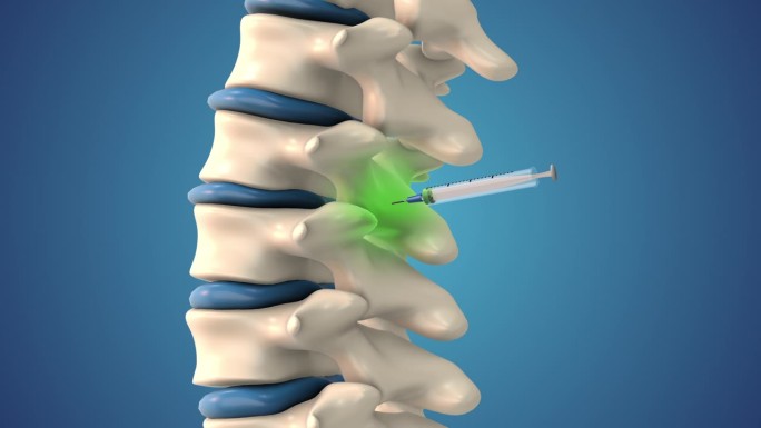 在动画中，干细胞被注射到脊椎中