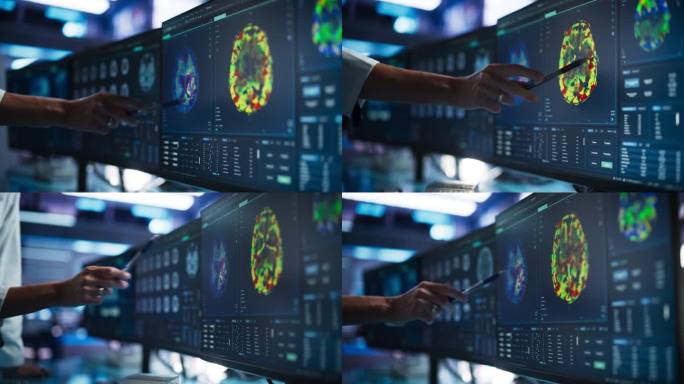 现代医学研究中心:匿名医生用软件指着桌面电脑显示器显示基于核磁共振扫描的人脑。神经学家在寻找脑损伤的