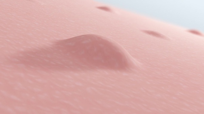 痤疮突然出现在脸上的皮肤。粉刺的产生和保护。