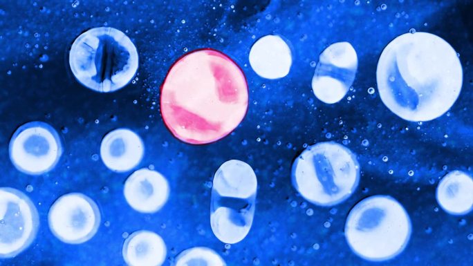 球体气泡就像变异的细胞。在显微镜背景下形成病变细胞