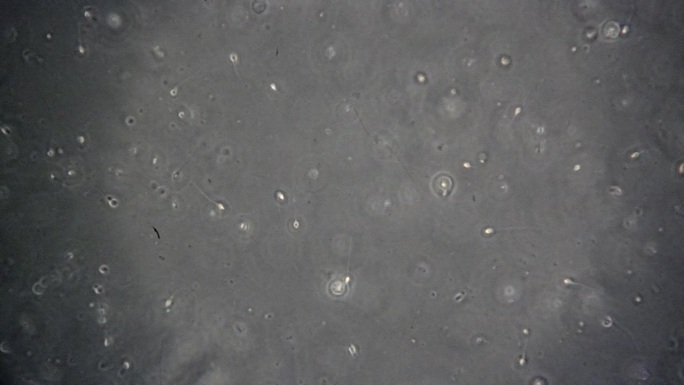 显微镜下看到的精子细胞，有的游动，有的死亡。