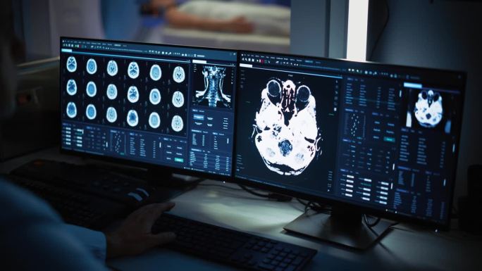 在医学实验室中，病人接受MRI或CT扫描过程，在控制室中，医生观察过程并监测脑部扫描结果。拥有高科技