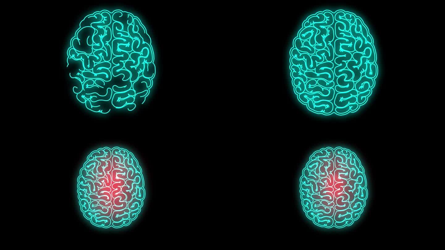 脑动画中的头痛区域。人类疼痛的大脑与红色刺激。压力、偏头痛和脑痛的科学与医学