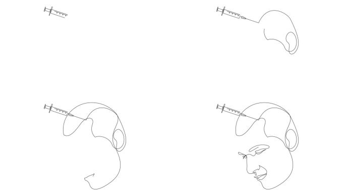 男性富血小板血浆注射过程的自绘动画，连续单线绘制。男性脱发治疗理念简约设计。头发生长刺激单线绘制。