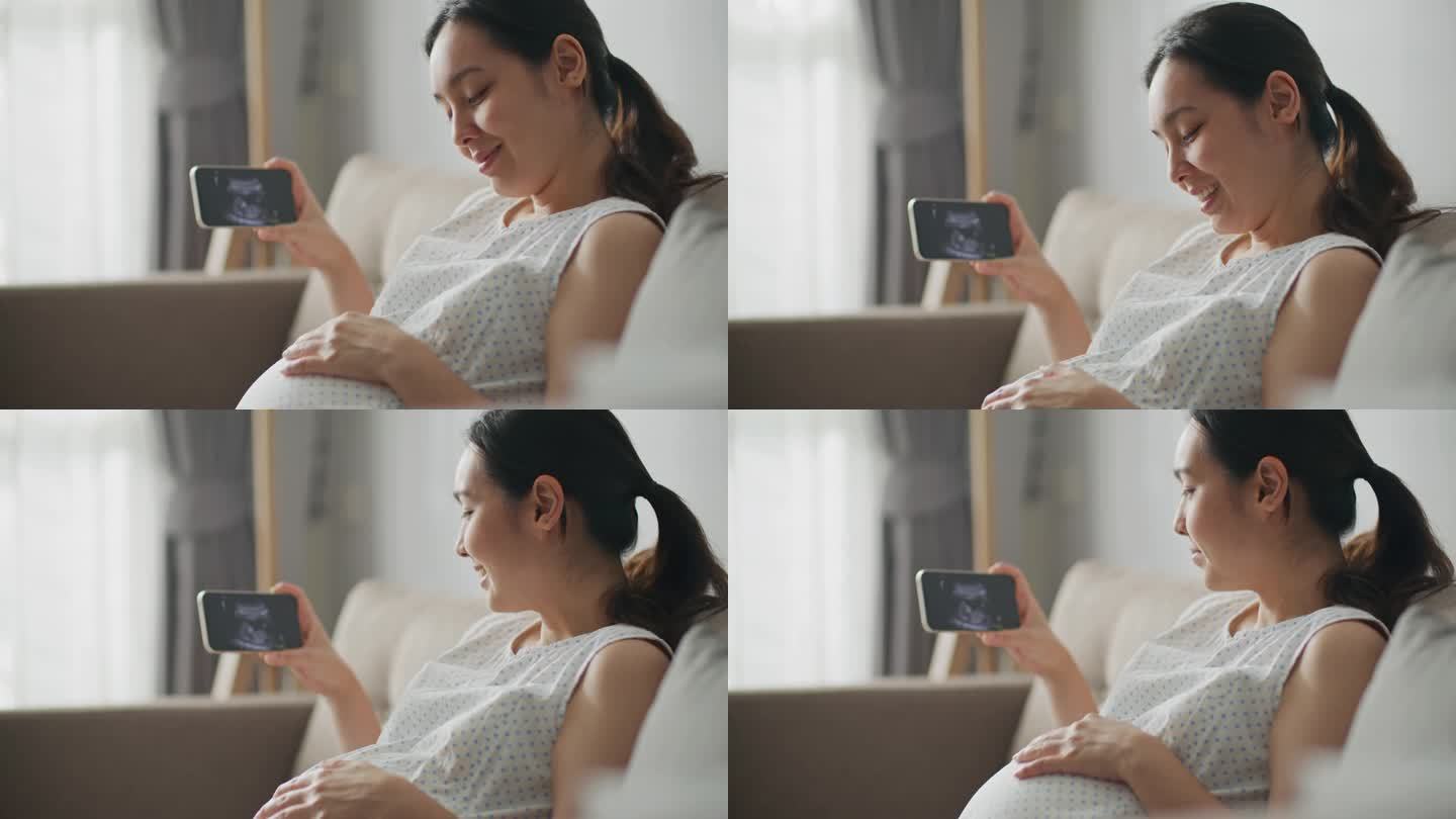 一位孕妇正在看超声波