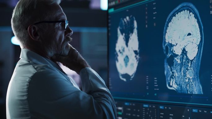 医学研究中心:白人男性神经学家、神经科学家、神经外科医生看着电视屏幕上的脑部CT扫描图像的特写。医生